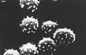 黒麹菌の顕微鏡での写真